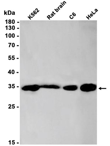 AYD14241