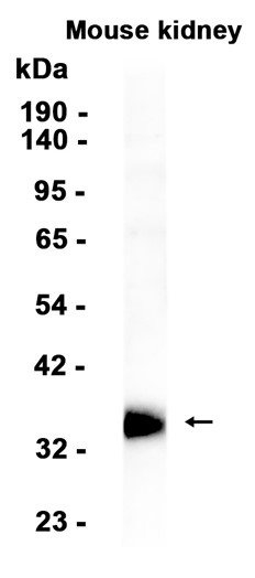 AYD13335