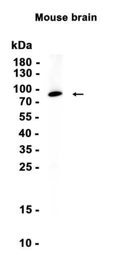 beta Catenin (YD17053) Rabbit mAb