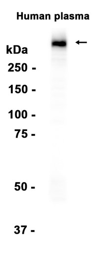 AYD14604
