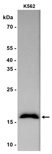 AYD16017