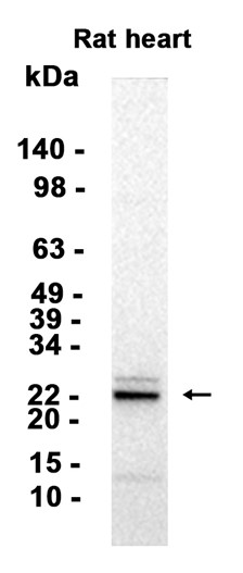 AYD15355