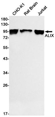 AYD11762
