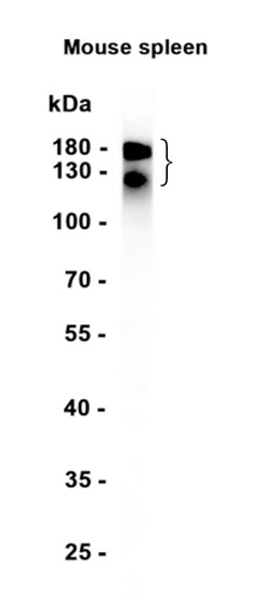 MERTK (YD11440) Rabbit mAb