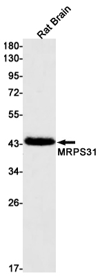 AYD11818