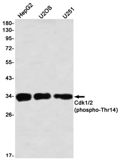 Phospho-CDK1/2 (Thr14) (YD31319) Rabbit mAb