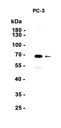 AYD15248