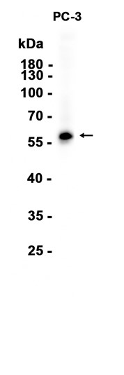 AYD14516