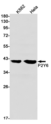 AYD12145