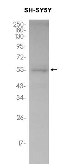 CaMKII alpha (YD31133) Rabbit mAb