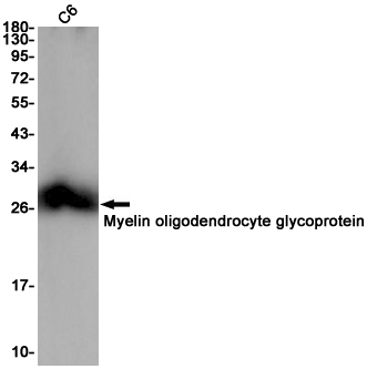AYD11415