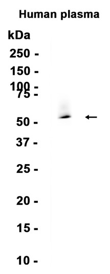 AYD13740