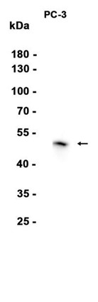 AYD14859