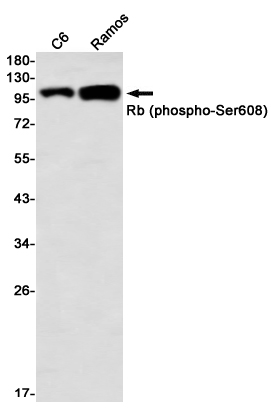 Phospho-Rb (Ser608) (YD32467) Rabbit mAb