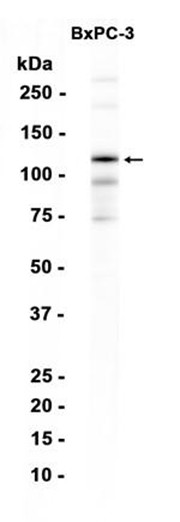 pan Cadherin (YD18716) Rabbit mAb