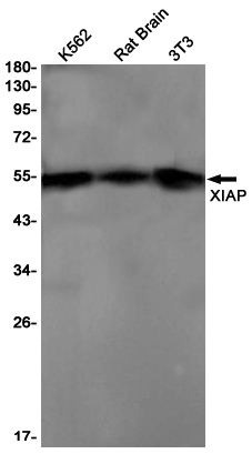 XIAP (YD16638) Rabbit mAb