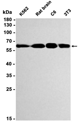 Catalase (YD14311) Rabbit mAb