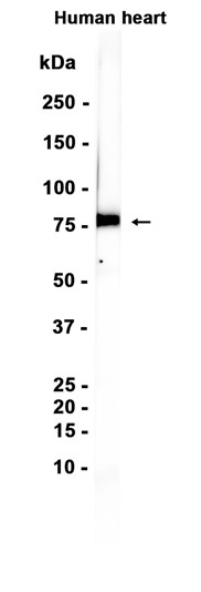 AYD15251