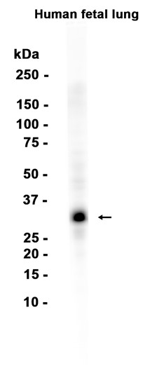 AYD14270