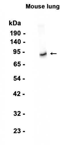 CD105 (YD18301) Rabbit mAb