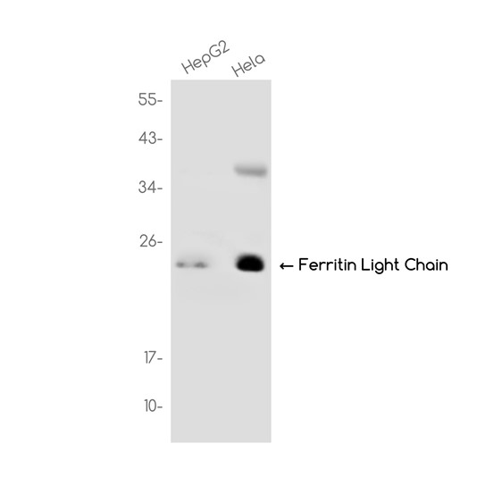 Ferritin Light Chain (YD31649) Rabbit mAb