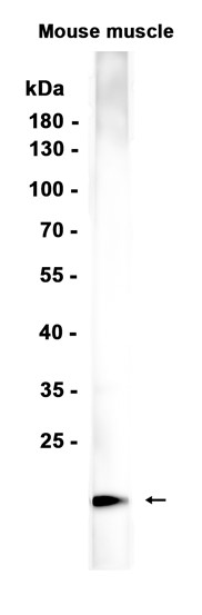 AYD15293