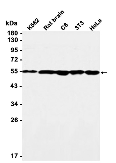 TRK fused (YD20446) Rabbit mAb