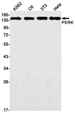 AYD11318