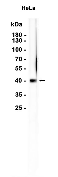 AYD14315