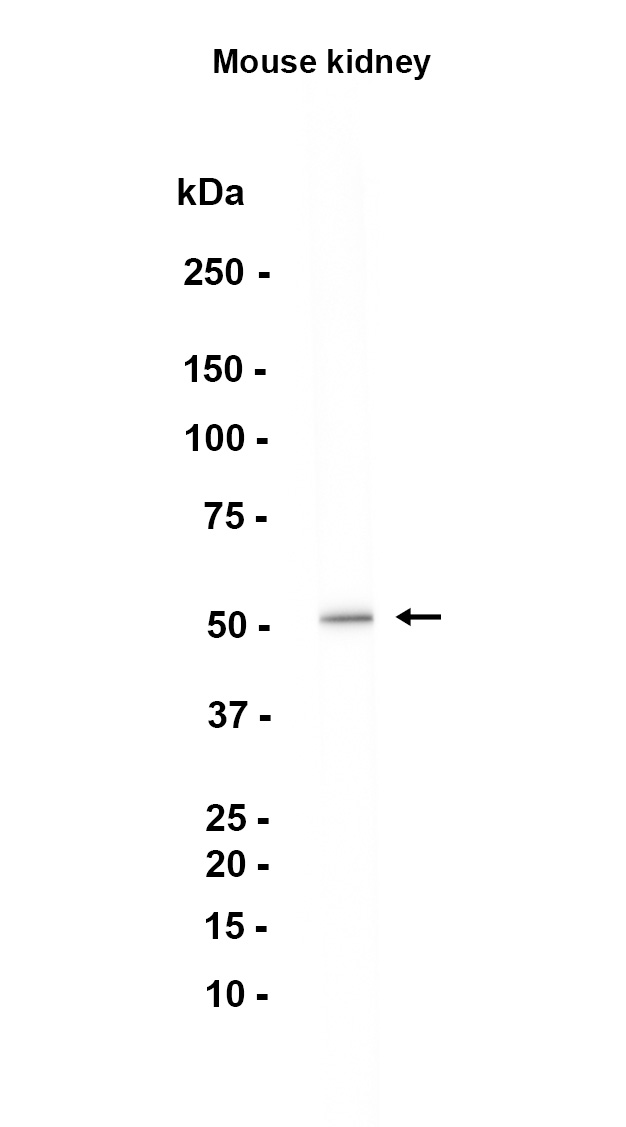 Acetyl-p53 (Lys305) (YD13712) Rabbit mAb