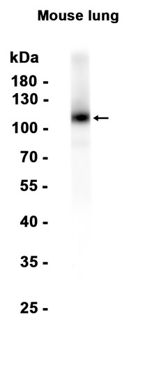 Thrombomodulin (YD19246) Rabbit mAb