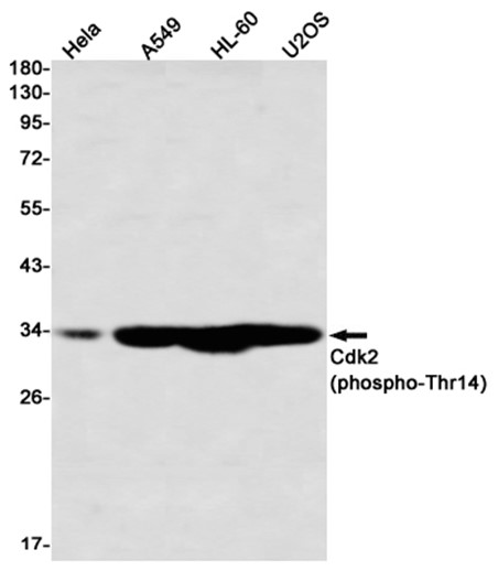 Phospho-CDK2 (Thr14) (YD33436) Rabbit mAb
