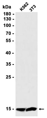 Cystatin C (YD13568) Rabbit mAb