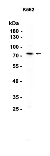AYD15240