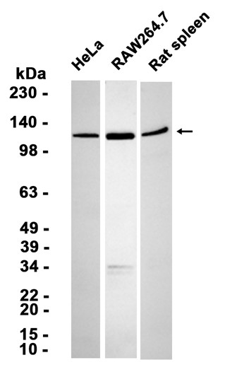 AYD14951
