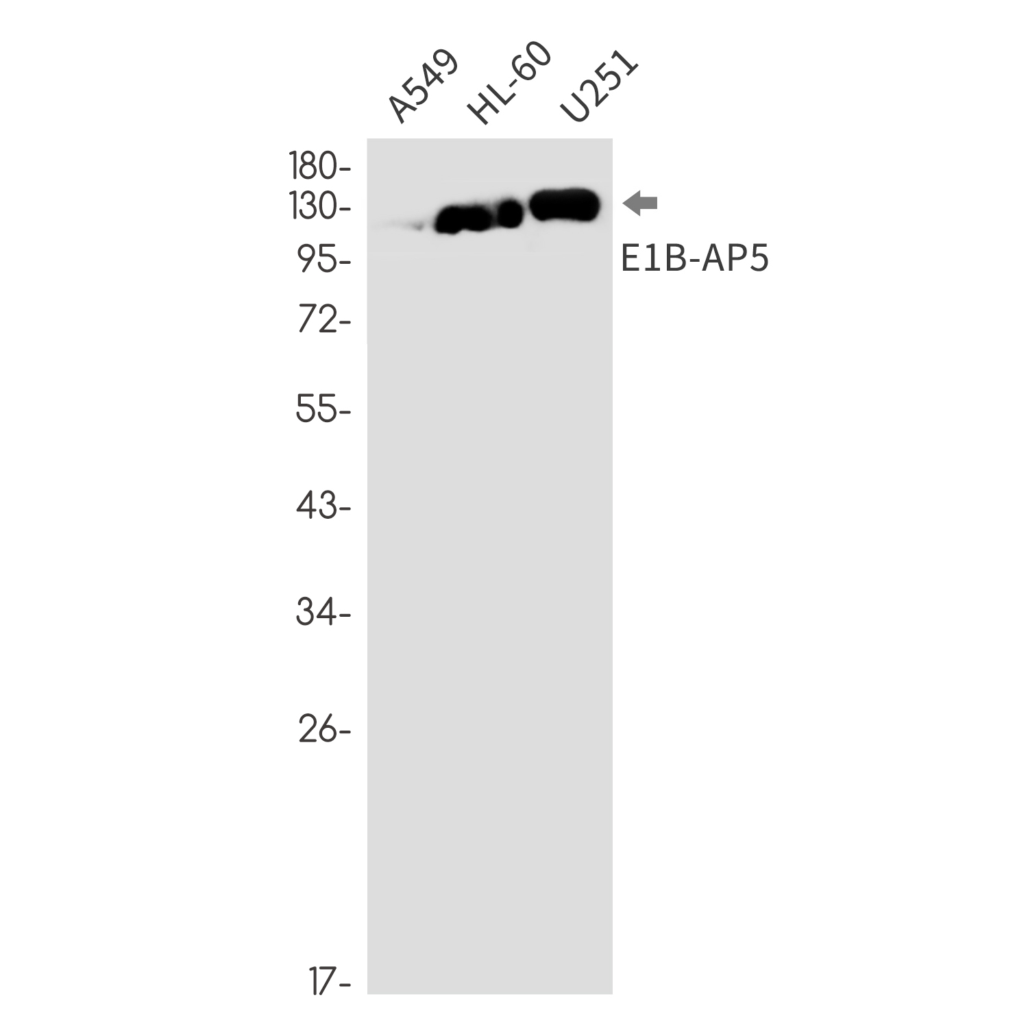 HNRNPUL1 (YD18740) Rabbit mAb