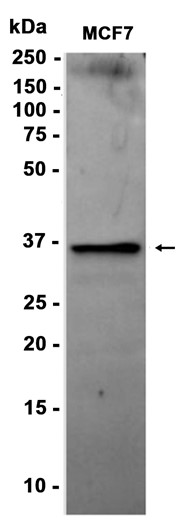 AYD11659
