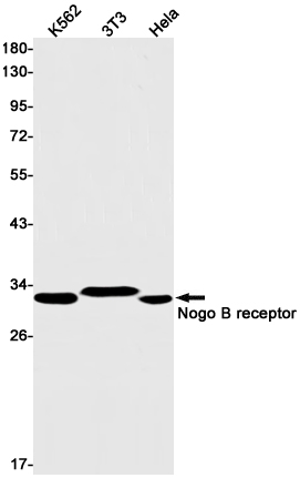 Nogo B receptor (YD15701) Rabbit mAb
