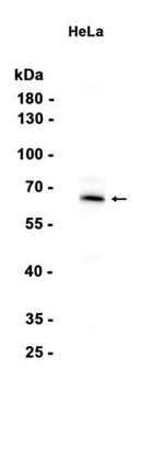AYD14770