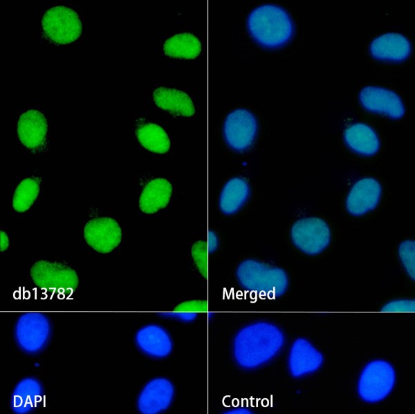 CAMKIV (YD31394) Rabbit mAb