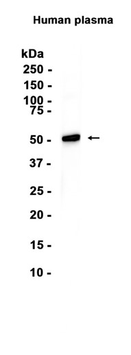 Vitamin D Binding protein (YD12868) Rabbit mAb