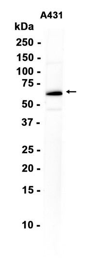 AYD16305