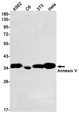 AYD11913