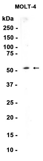 AYD12554