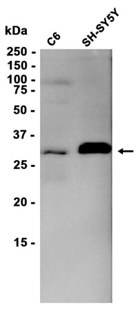 BDNF (YD13685) Rabbit mAb