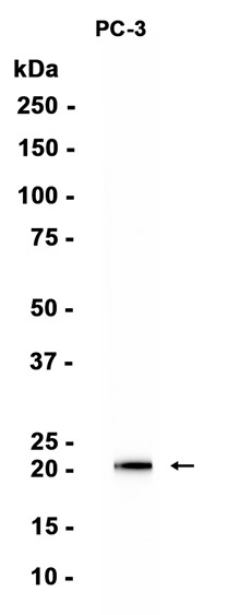 AYD15406
