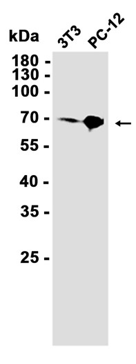 ATF2 (YD21041) Rabbit mAb
