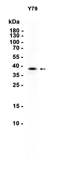 AYD14925