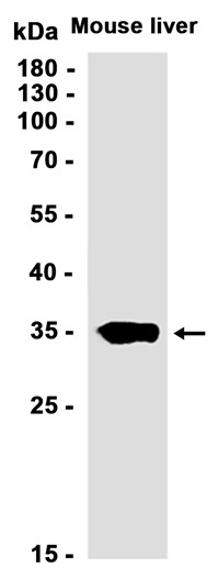 Liver Arginase (YD21007) Rabbit mAb