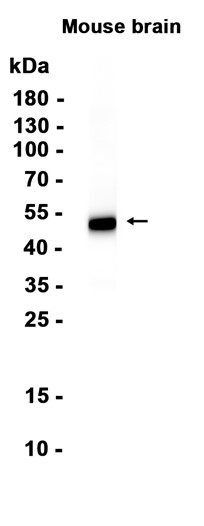 Acetyl-alpha Tubulin (Lys40) (YD12213) Rabbit mAb